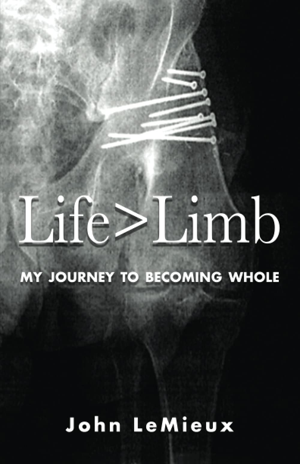 Life is Greater Than Limb cover photo showing resilience and inspiration for readers.