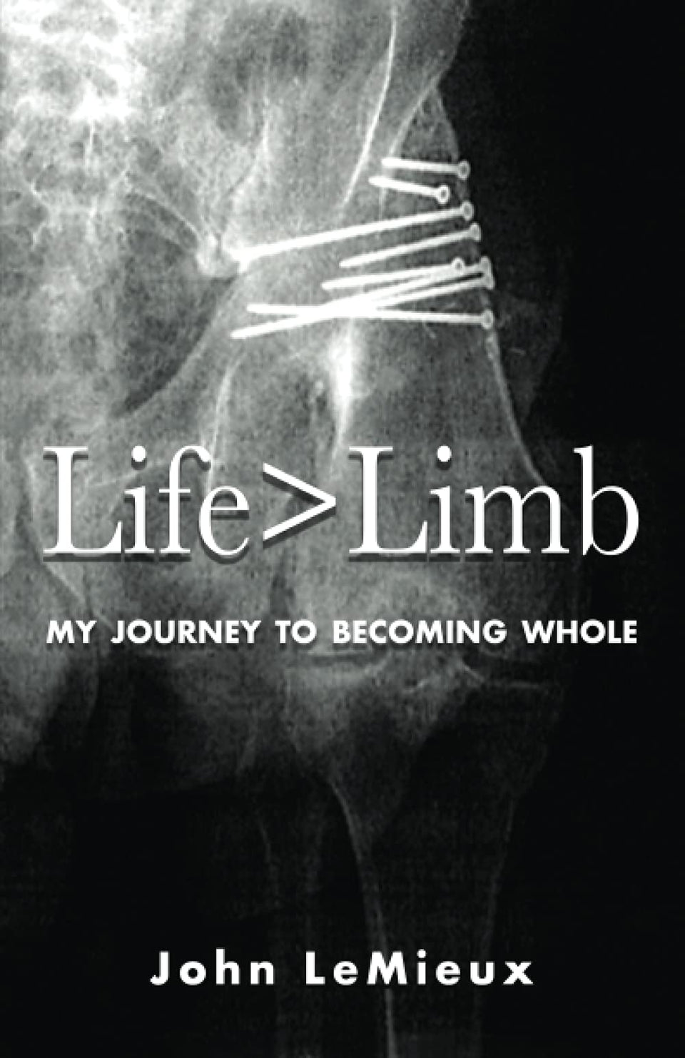 Life is Greater Than Limb cover photo showing resilience and inspiration for readers.
